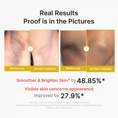 Kojic Acid Turmeric Body Peel Shot