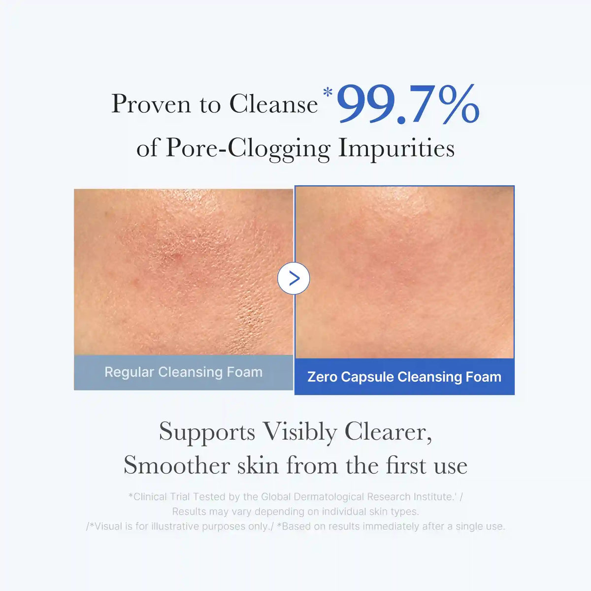 Zero Pore Capsule Cleansing Foam