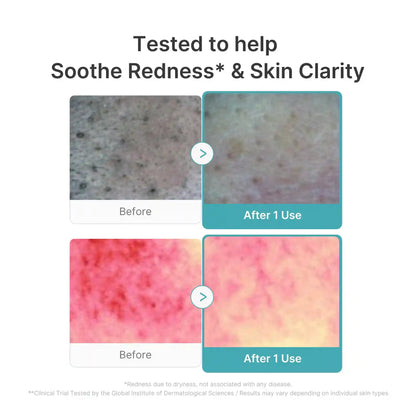 Azelaic Acid Capsule Foam Cleanser