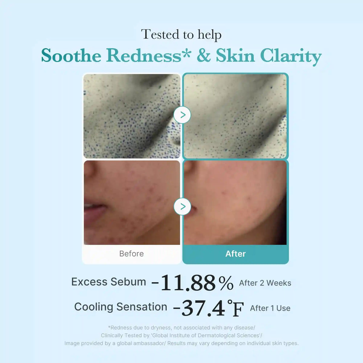 Azelaic Acid Niacinamide Clarifying Toner