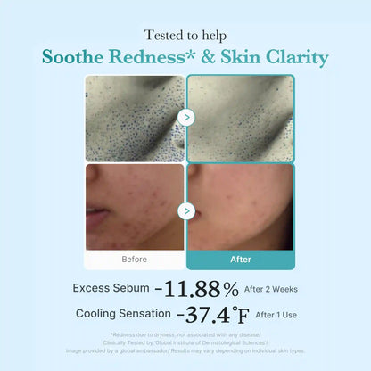 Azelaic Acid Niacinamide Clarifying Toner