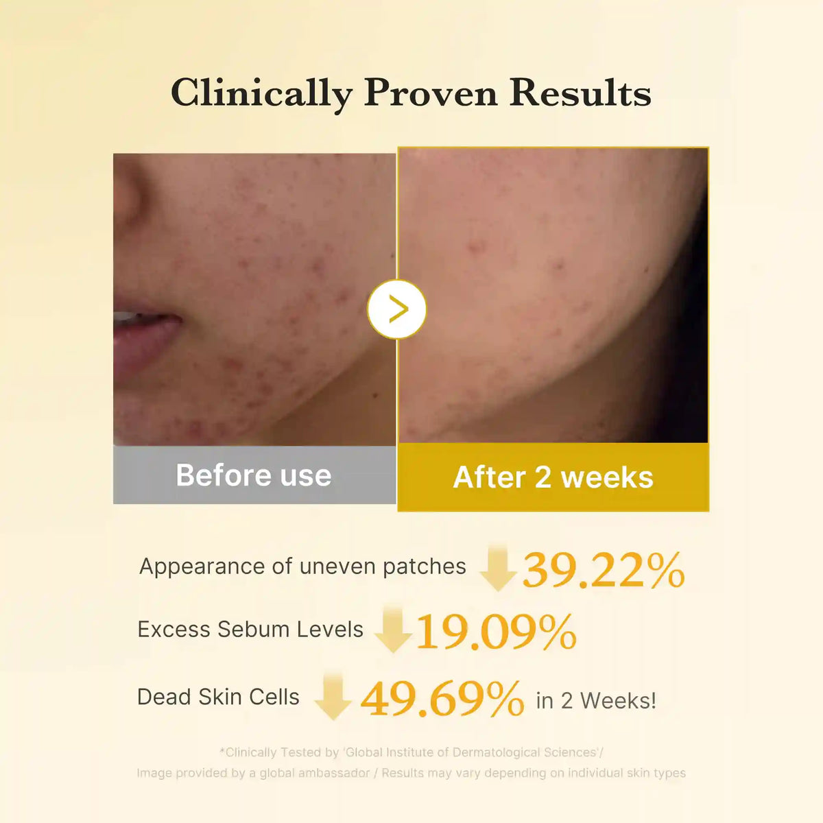 [Subscr.] Kojic Acid Turmeric Toner Pad