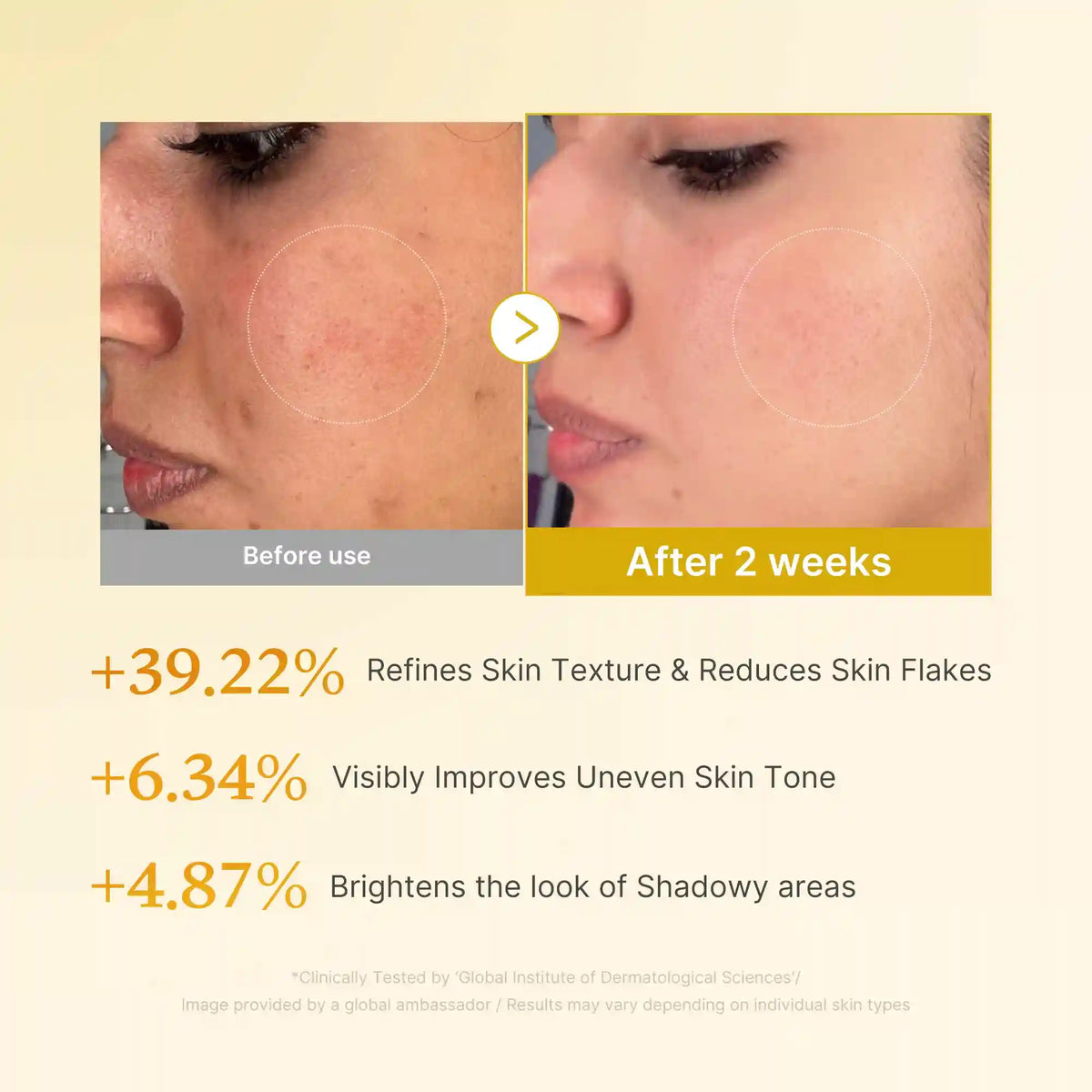 [GIFT] Kojic Acid Turmeric Toner
