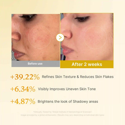 [GIFT] Kojic Acid Turmeric Toner