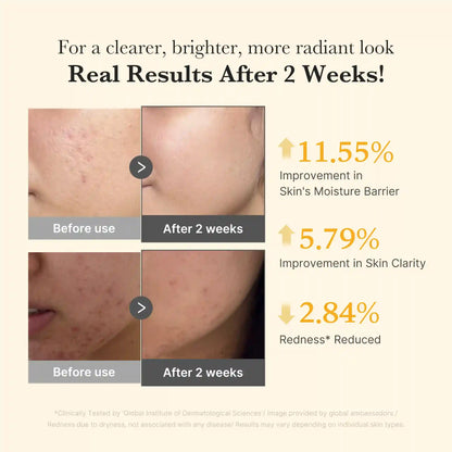 [GIFT] Kojic Acid Turmeric Capsule Serum
