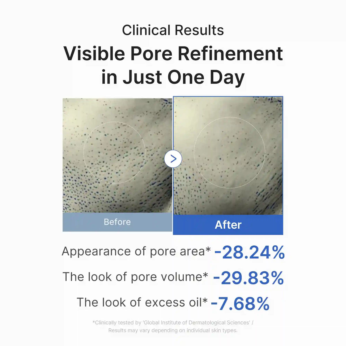 [GIFT] Zero Pore One-day Peptide Serum