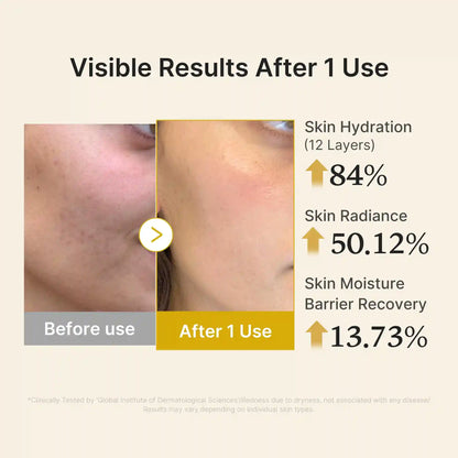 Kojic Acid Turmeric Vitamin Gold Jelly Mist Serum