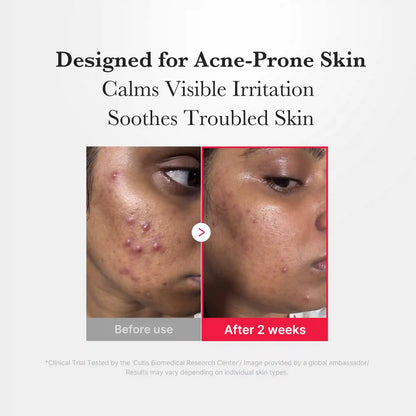 [Subscr.] Hypochlorous Acid Power Soothing Spray