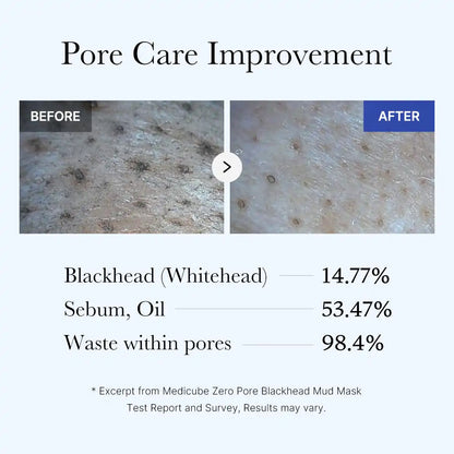 [GIFT] Zero Pore Blackhead Mud Mask