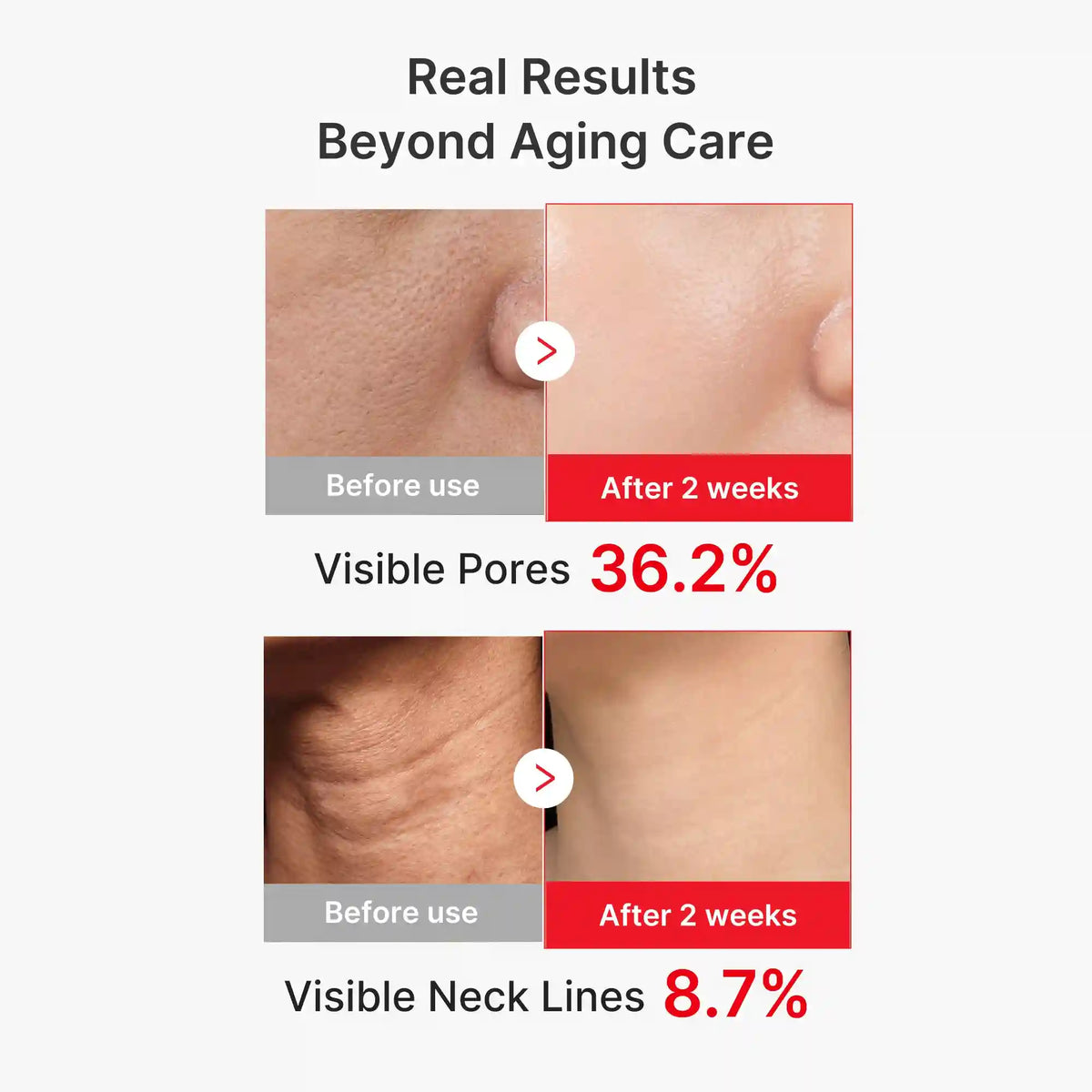 7-Day Anti-Aging & Plump Set
