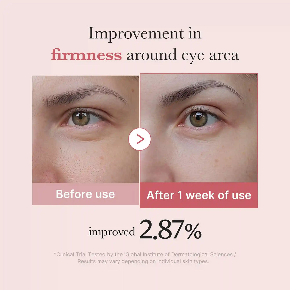 PDRN Pink Peptide Eye Cream
