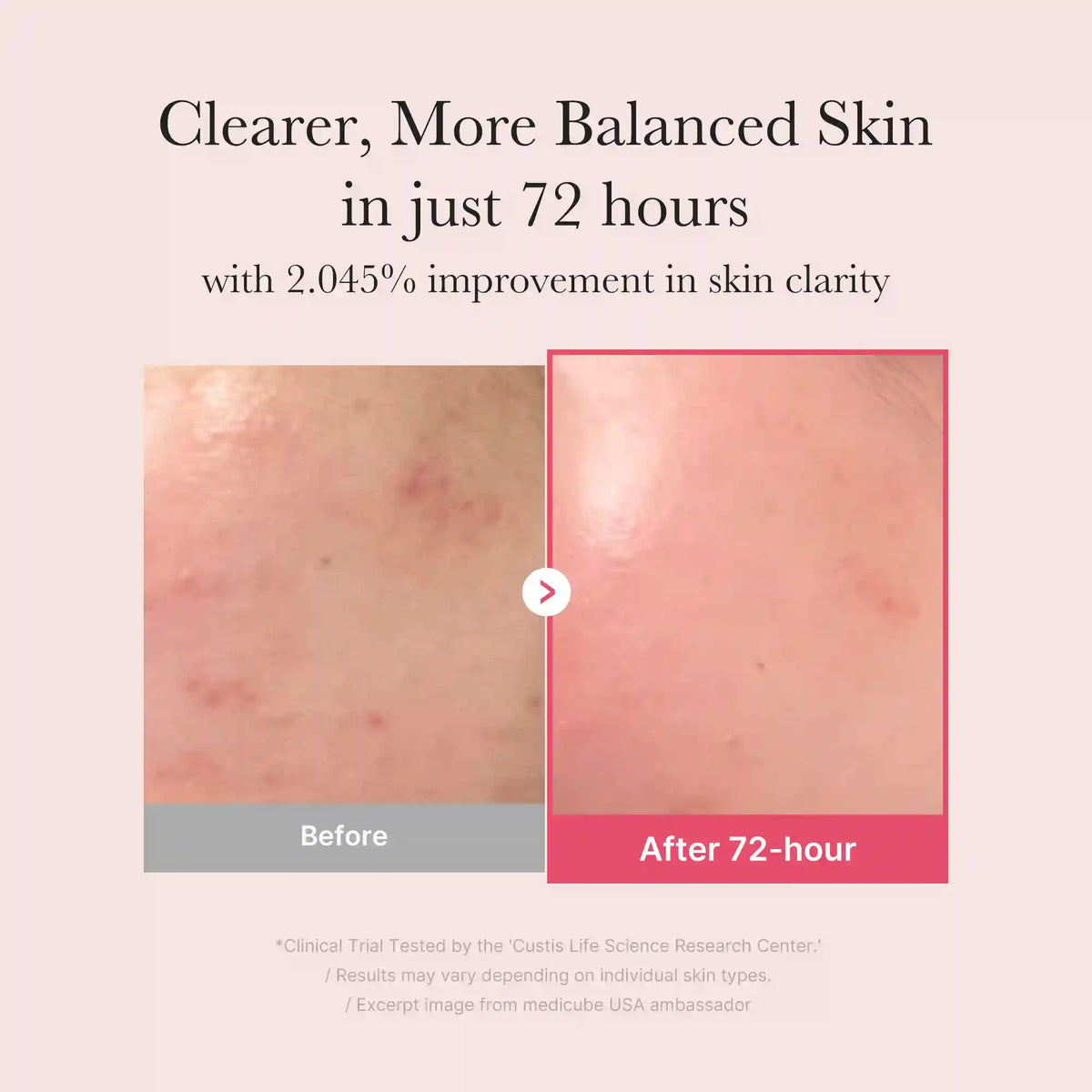 [GIFT] TXA Niacinamide Serum