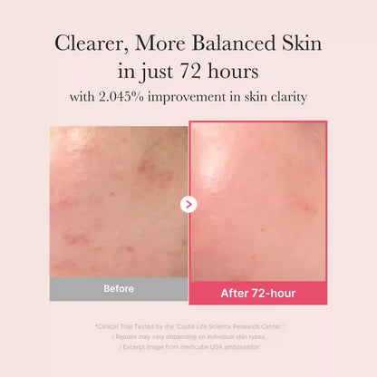 [GIFT] TXA Niacinamide Serum